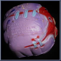 Fist Face from Madballs - Series 2 manufactured by AmToy [Loose]